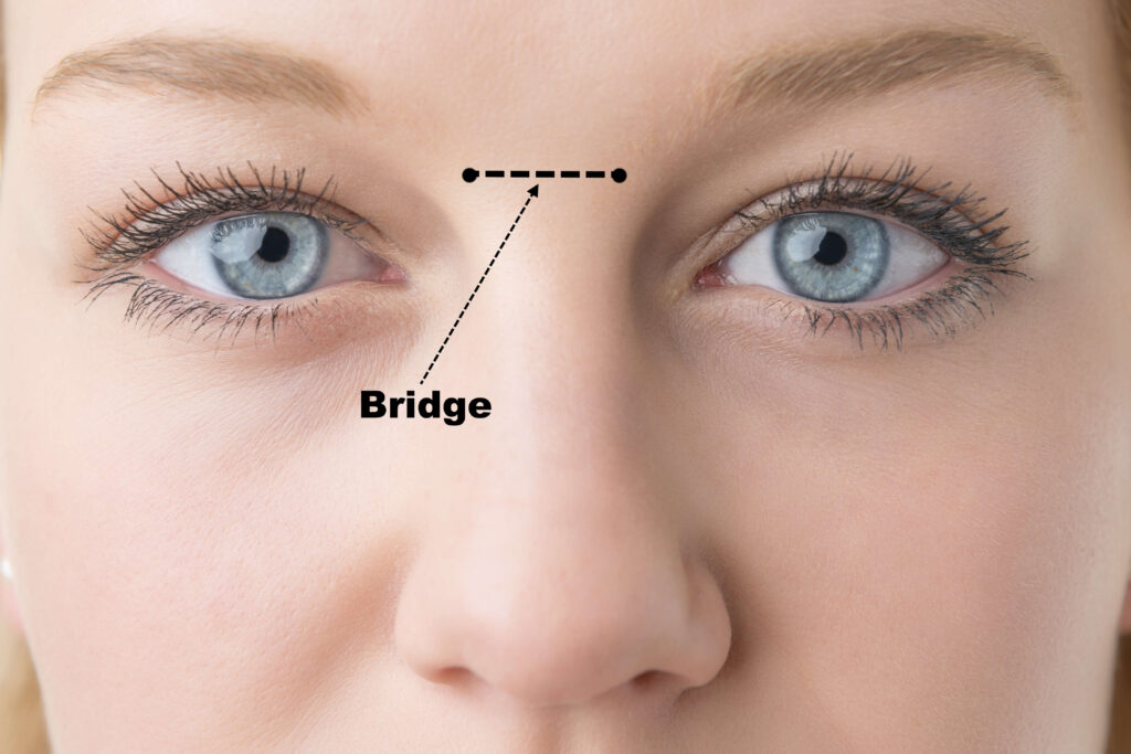 A diagram point out the location of the bridge on a woman's face.
