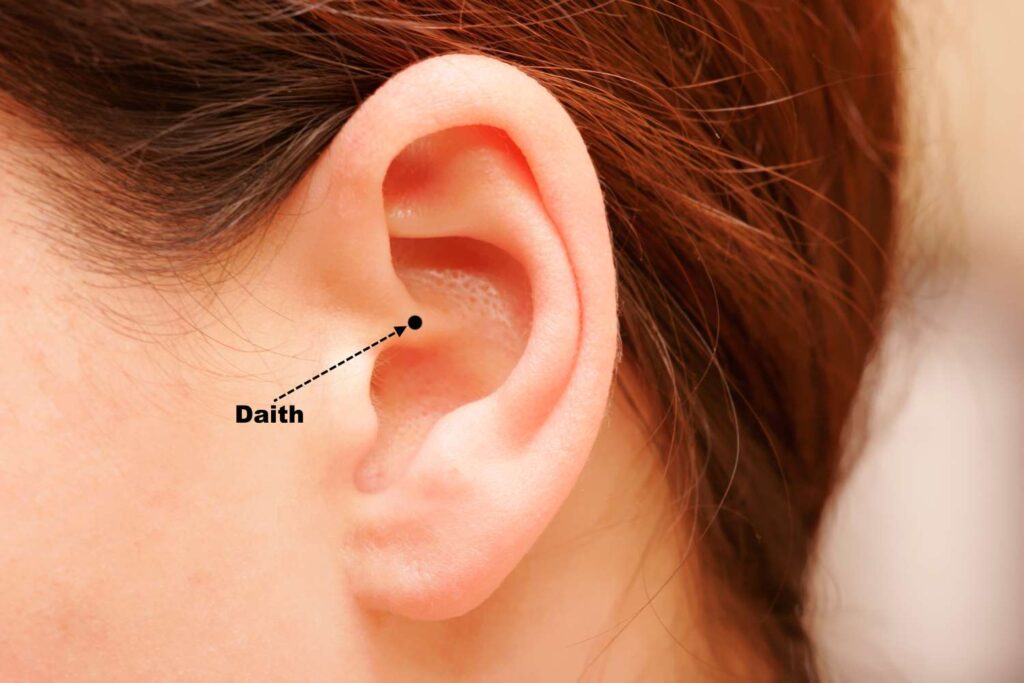 A womans ear showing the location of the daith.