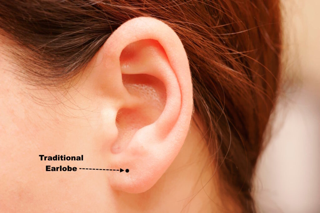A diagram of an ear on a woman with long hair that has a traditional lobe piercing.