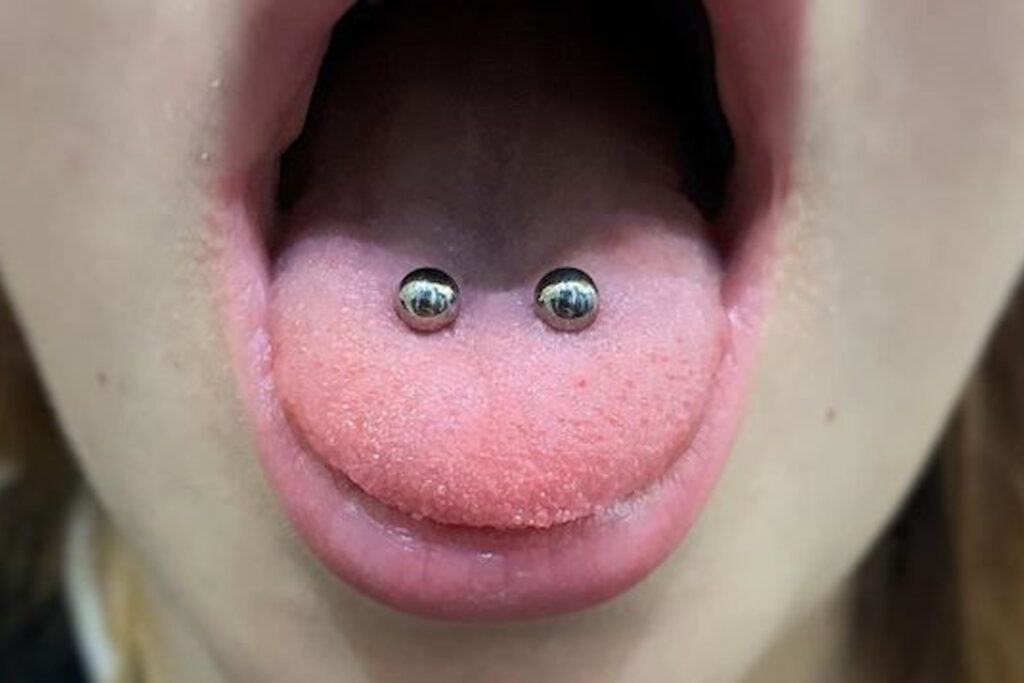 A double tongue piercing on a person.