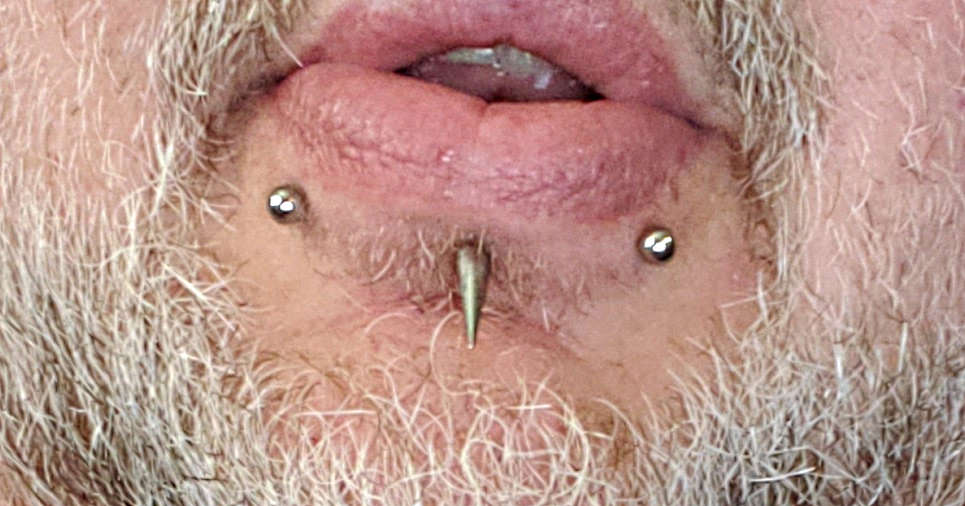 A labret piercing and a pair of snakebite piercings.