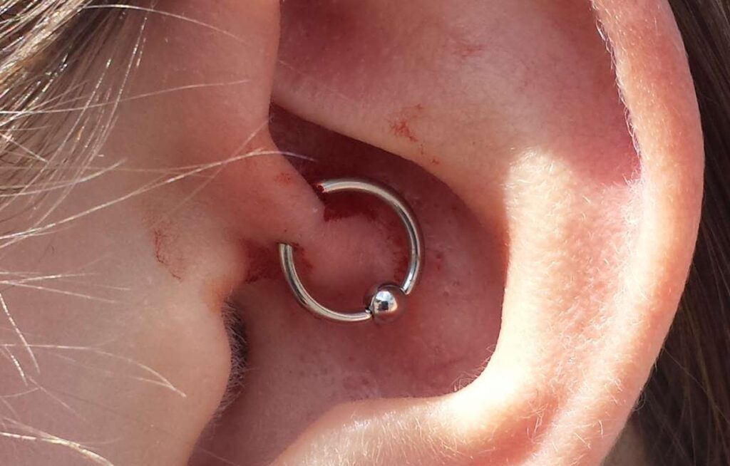 A close up of a daith piercing in a person's ear.