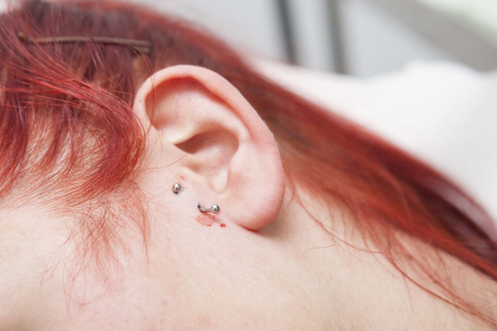 A red hair female with a new surface tragus.