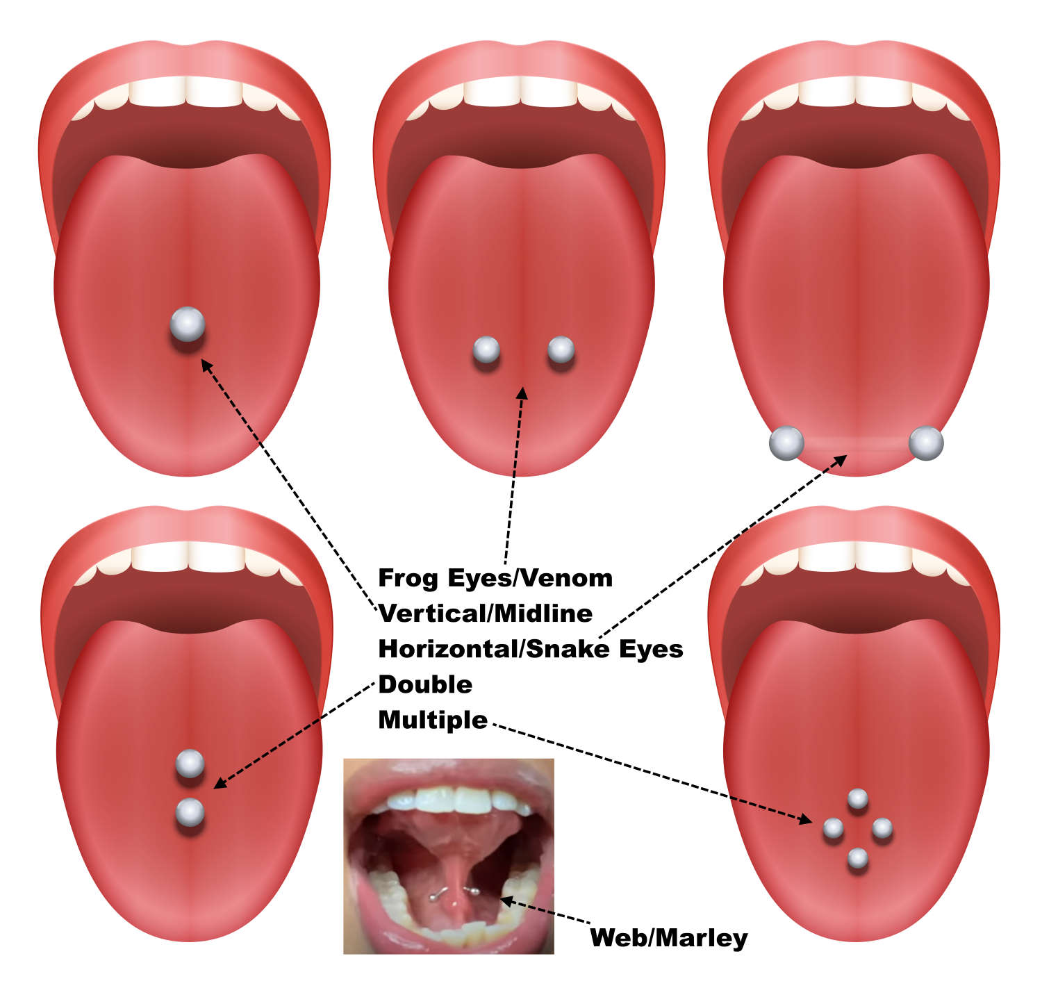 Six tongue piercing locations with illustrations of five of the piercings and a photo of a web piercing.